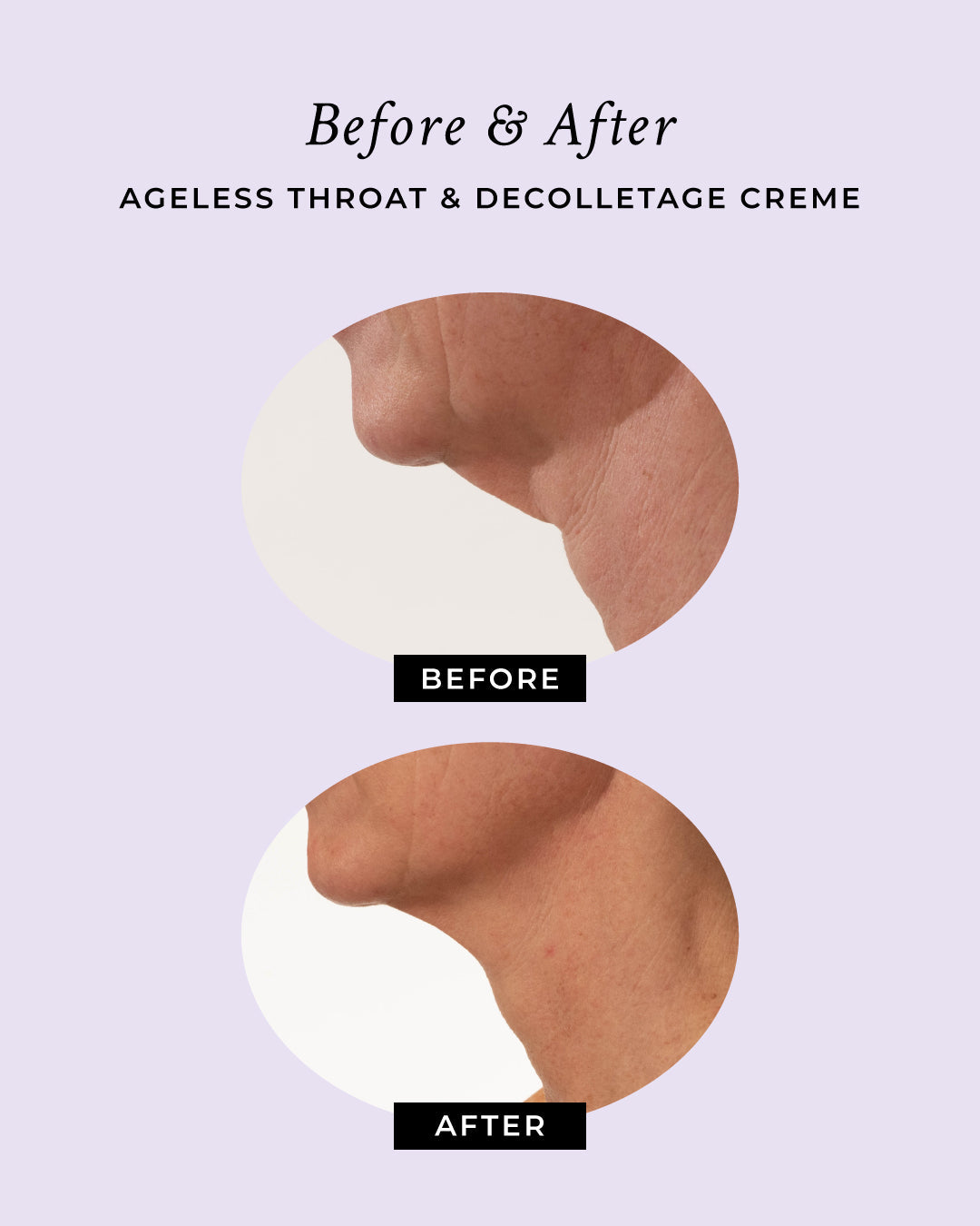PRAI Beauty — Ageless Throat & Décolletage Crème